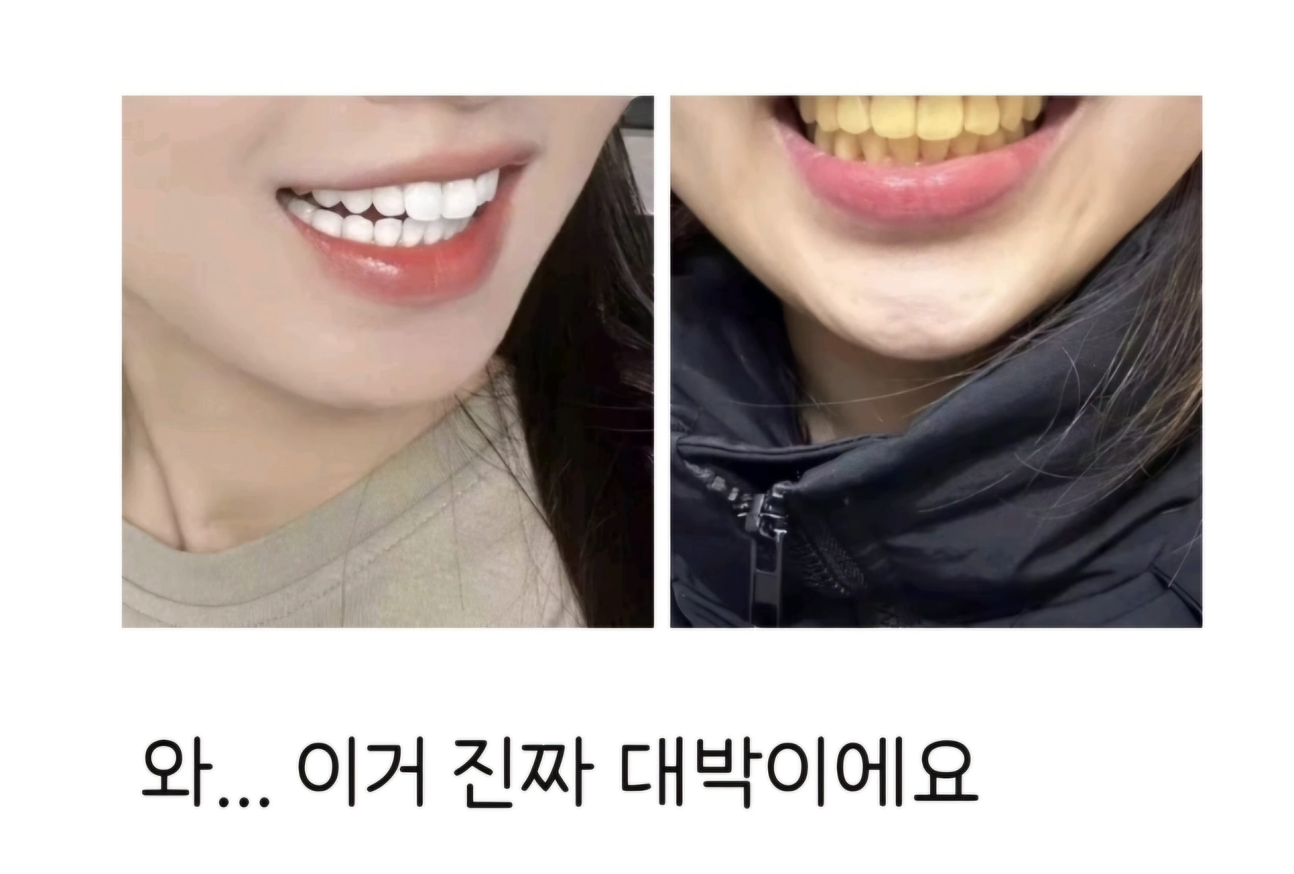 [잡담] 나 치아미백제 사려는데 후기 포토샵봐ㅋㅋㅋㅋㅋㅋㅋ | 인스티즈