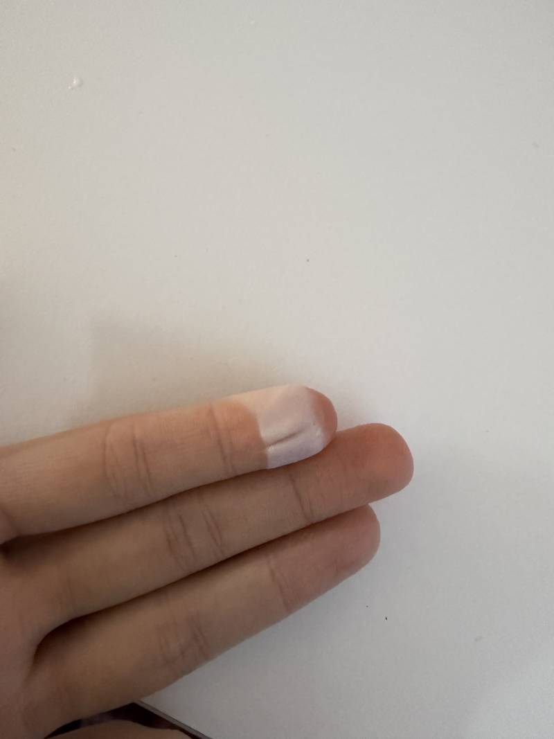 [잡담] 손 죽은걸까 ㅠㅠㅠㅠ ㅎㅇㅈㅇ | 인스티즈