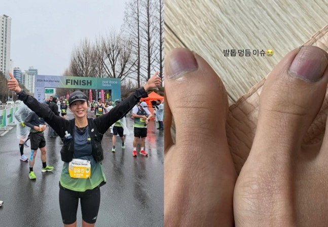 [정보/소식] 역시 무쇠소녀 유이, 피멍든 발톱으로 첫 하프마라톤 완주 "열심히 살아갈 이유” | 인스티즈