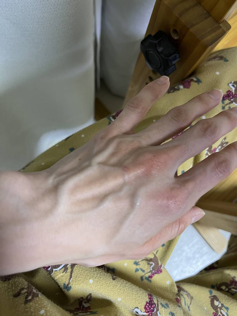 [잡담] 사람들이 신기해하는 내 핏줄 | 인스티즈