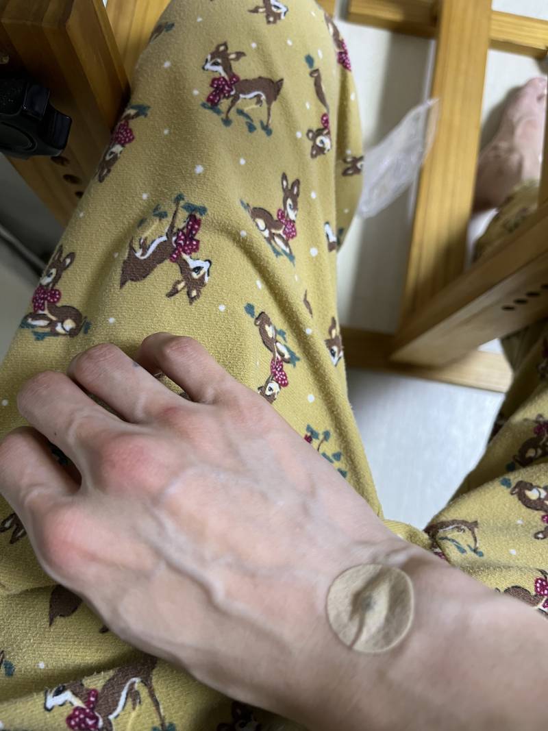 [잡담] 사람들이 신기해하는 내 핏줄 | 인스티즈