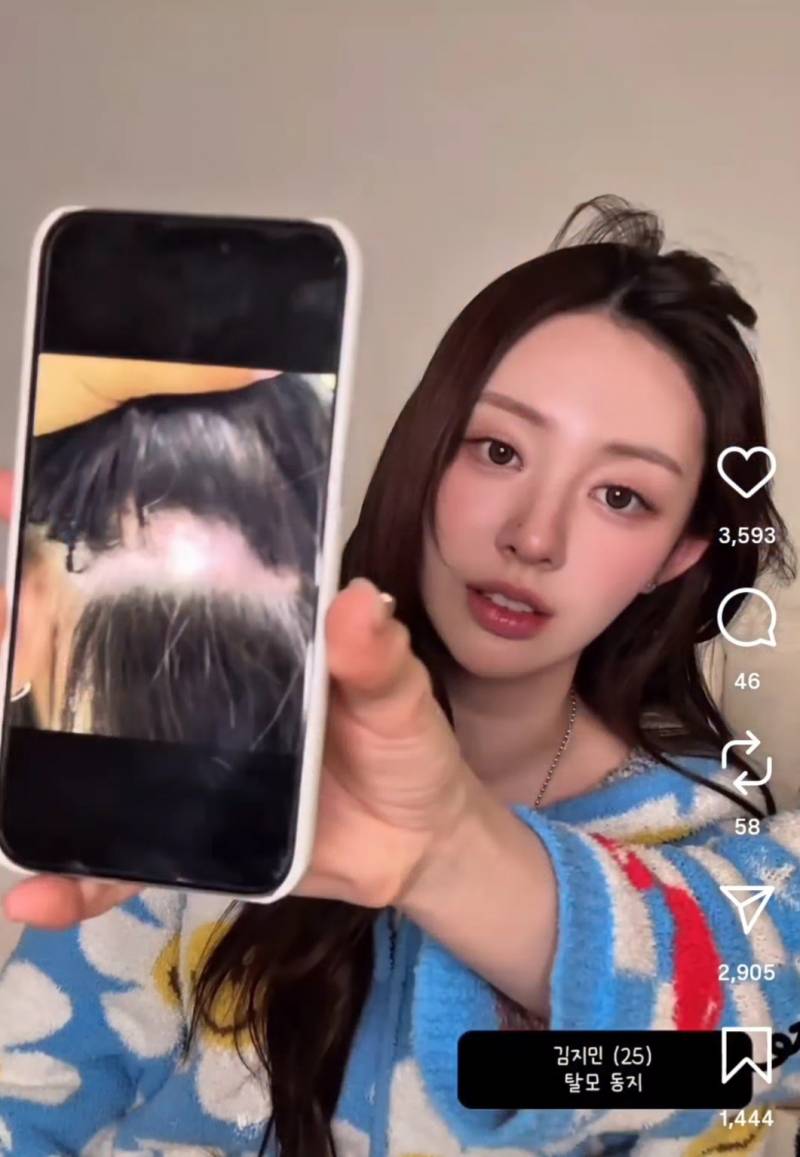 [잡담] 아니 환연 지연 탈모 진짜 심한데? | 인스티즈