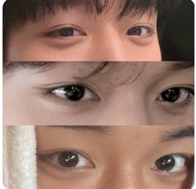 [잡담] 쌍수로 되는 눈일까? | 인스티즈