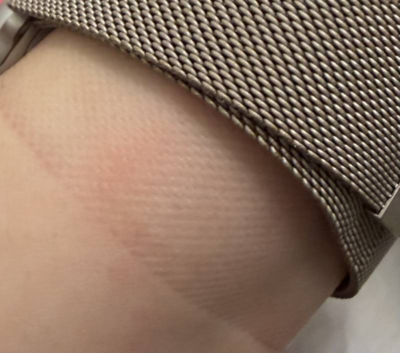 [잡담] 애플워치 자국좀봨ㅋㅋ | 인스티즈