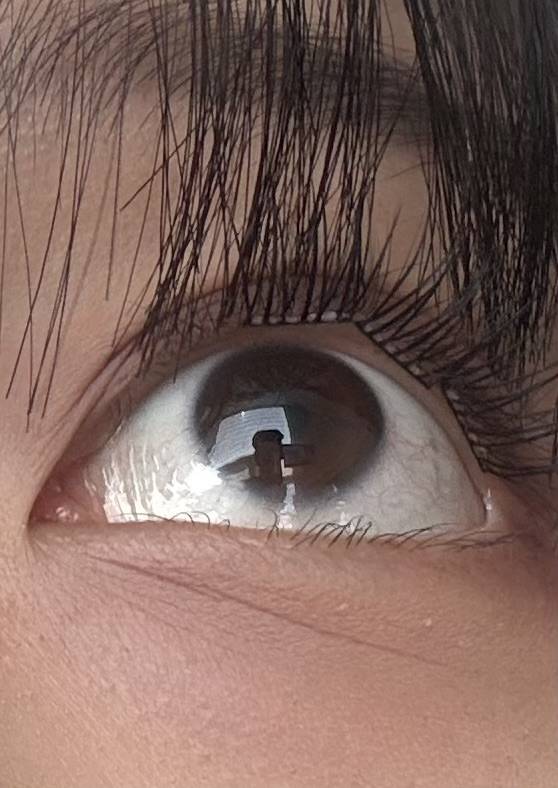 [잡담] 노글루 속눈썹 붙이는 익있오??? 나좀봐줘… | 인스티즈
