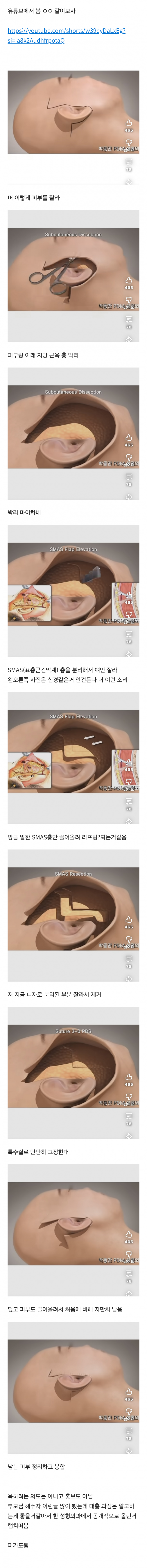 (충격주의) 현재 미용계를 휩쓸고있는 거상술 과정..JPG | 인스티즈