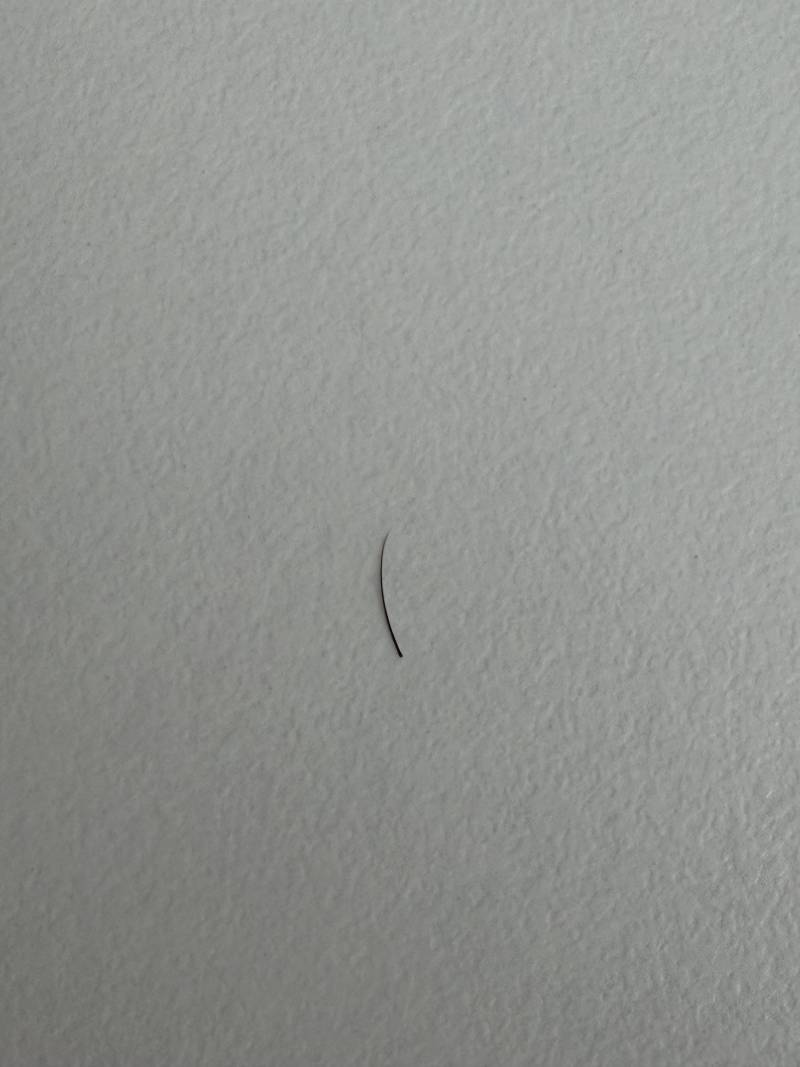 [잡담] 잇몸에서 머리카락이 자랄 수 있어? | 인스티즈
