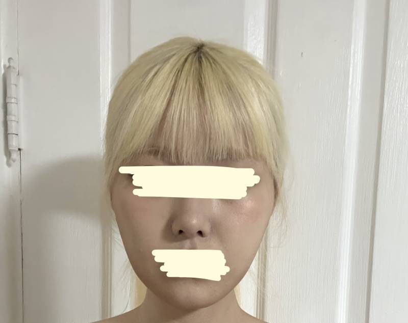 [잡담] 윤곽할까? 얼굴형좀 봐줄사람 | 인스티즈