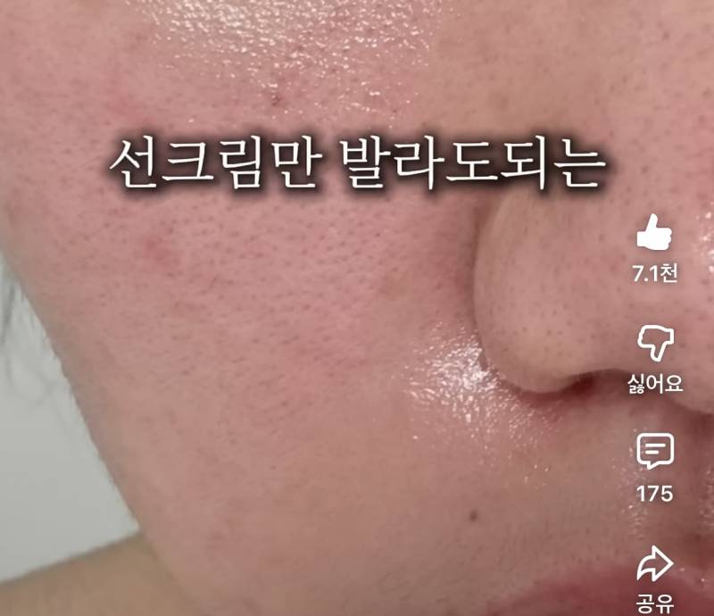 [잡담] 이런 피부도 피부과가면 약처방해줘? | 인스티즈