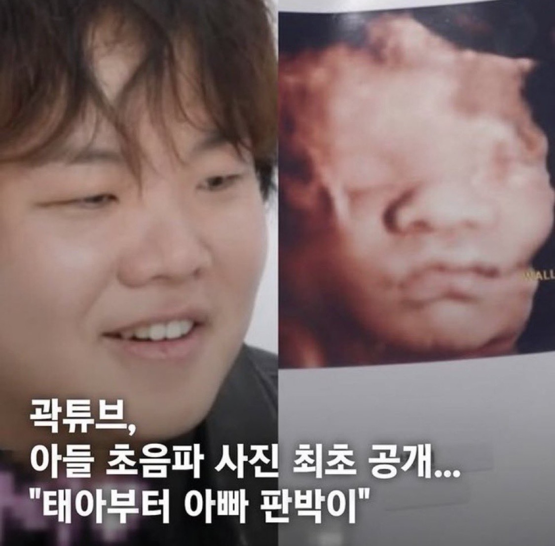 [잡담] 와 곽튜브 애기 초음파 사진부터 곽튜브임 | 인스티즈