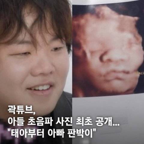 [잡담] 곽튜브 아들 초음파 사진 떴다 | 인스티즈