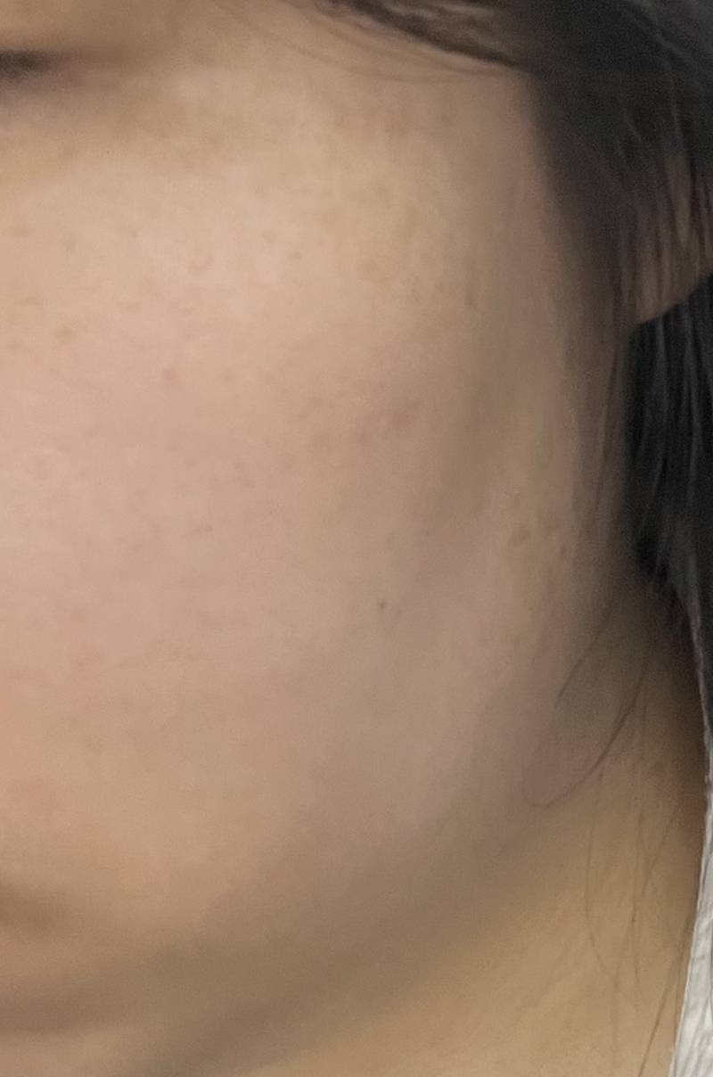 [잡담] 볼 옆에 턱살은 어케빼? | 인스티즈