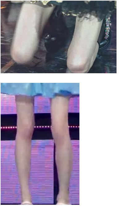 [잡담] 뼈말라가 추구미인 익들은 다리 이런걸 원하는겨? | 인스티즈