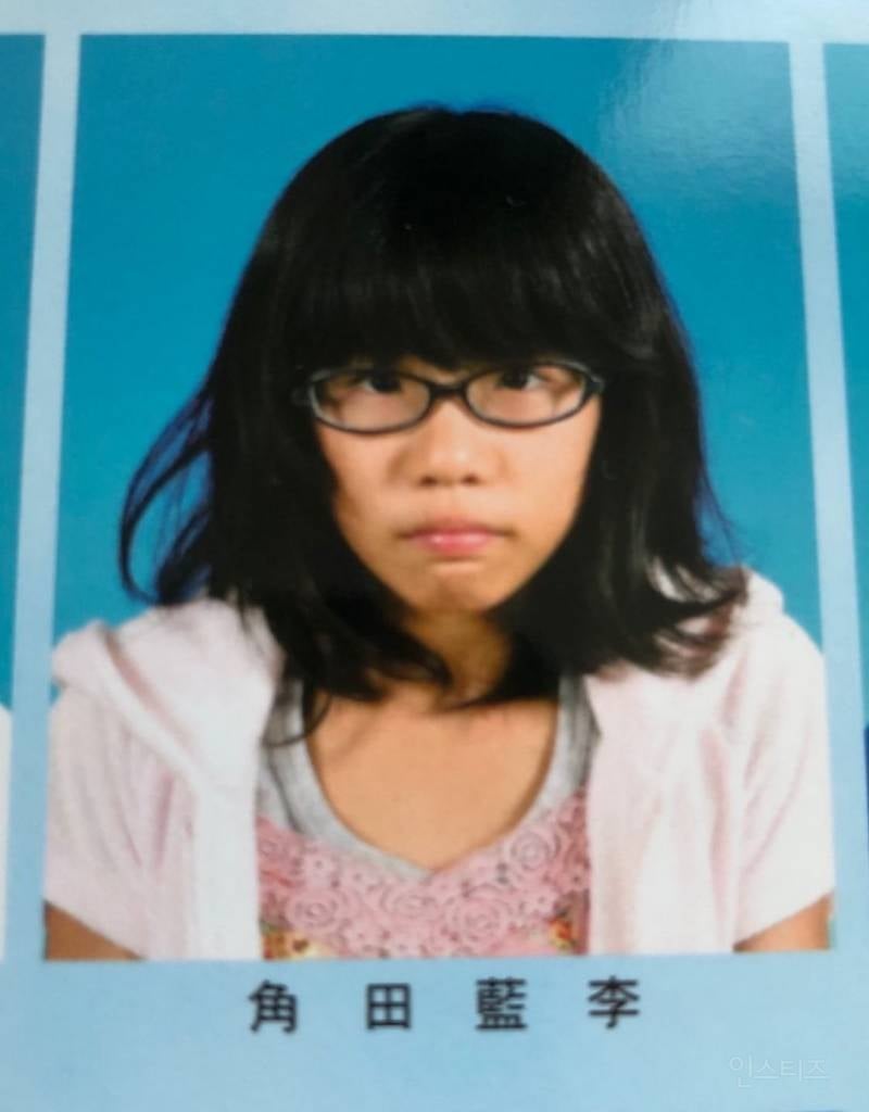 외모컴플렉스로 잠도 안자고 일해서 성형함.jpg | 인스티즈
