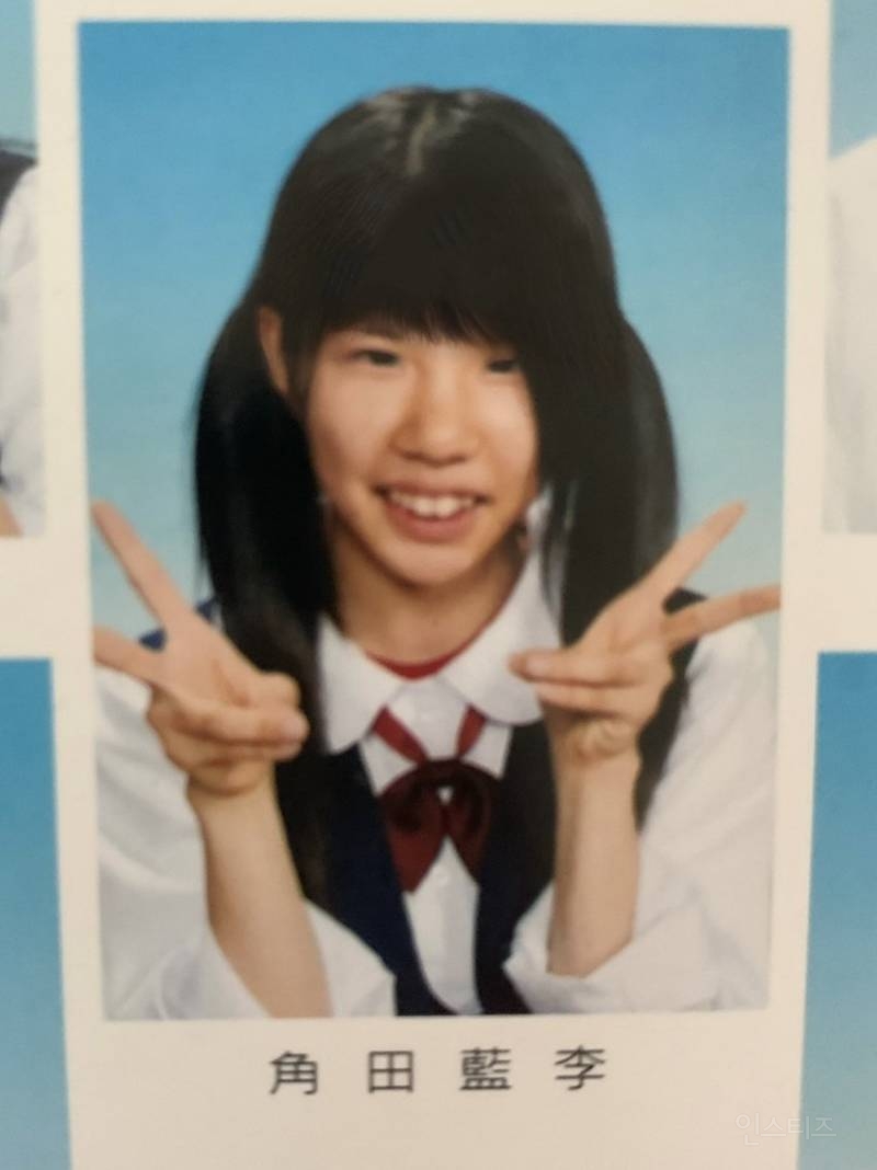 외모컴플렉스로 잠도 안자고 일해서 성형함.jpg | 인스티즈