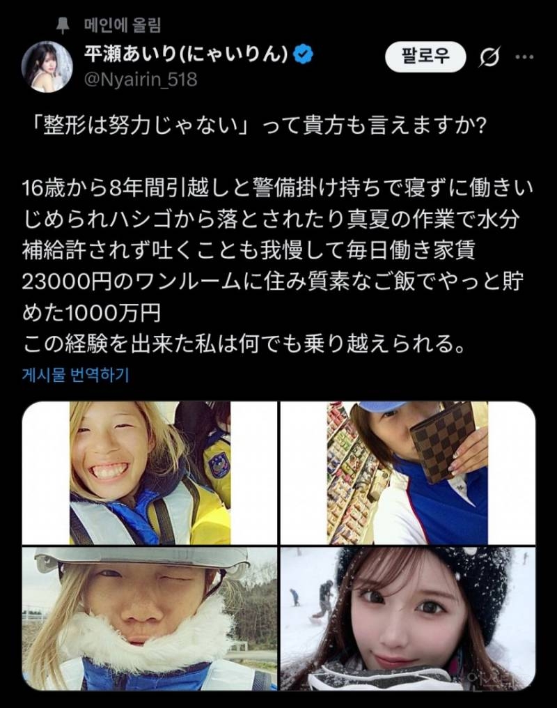 외모컴플렉스로 잠도 안자고 일해서 성형함.jpg | 인스티즈