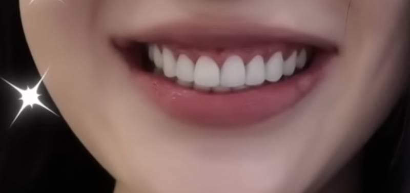 [잡담] 와 라미네이트 이정도로 갈아? | 인스티즈