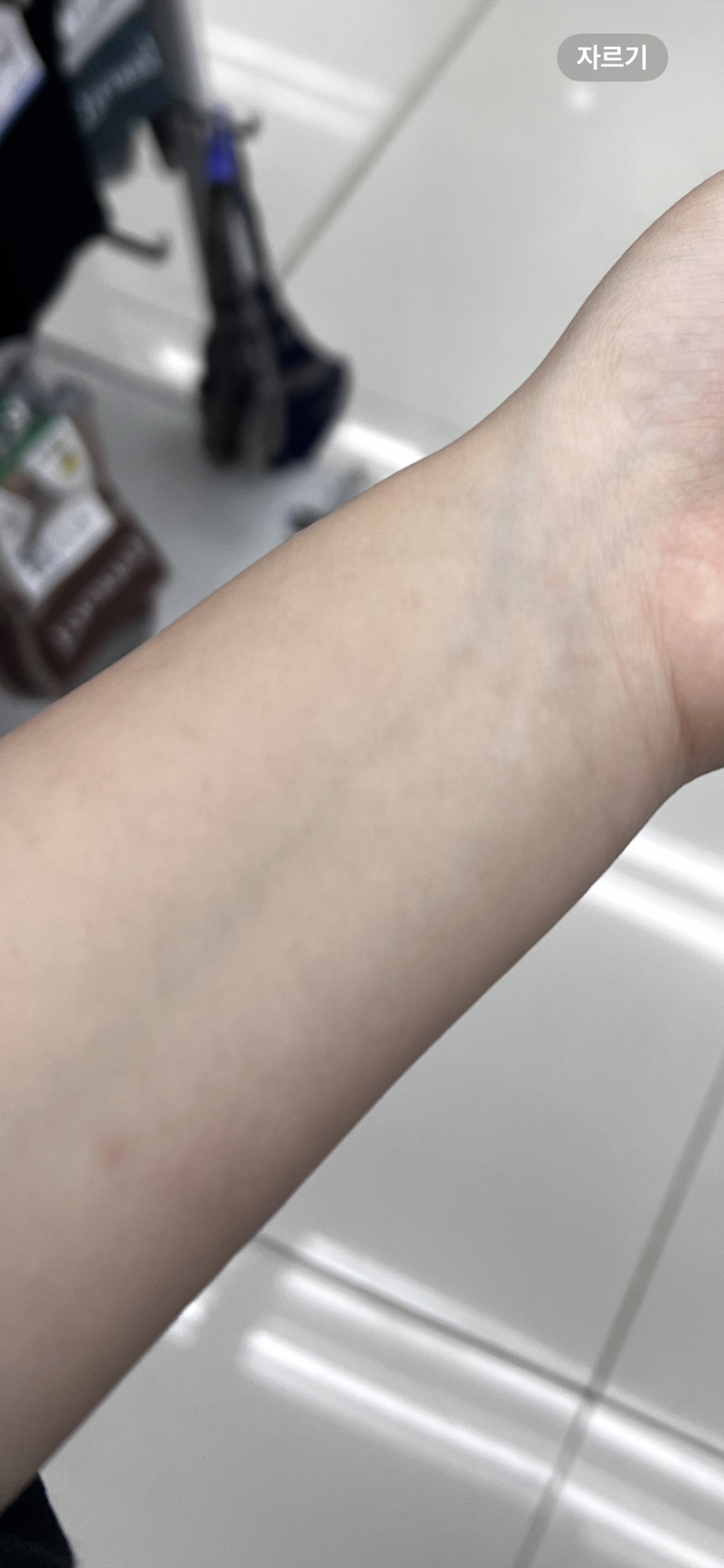 [잡담] 피부가 앏은거야..?징그러워보임.. | 인스티즈