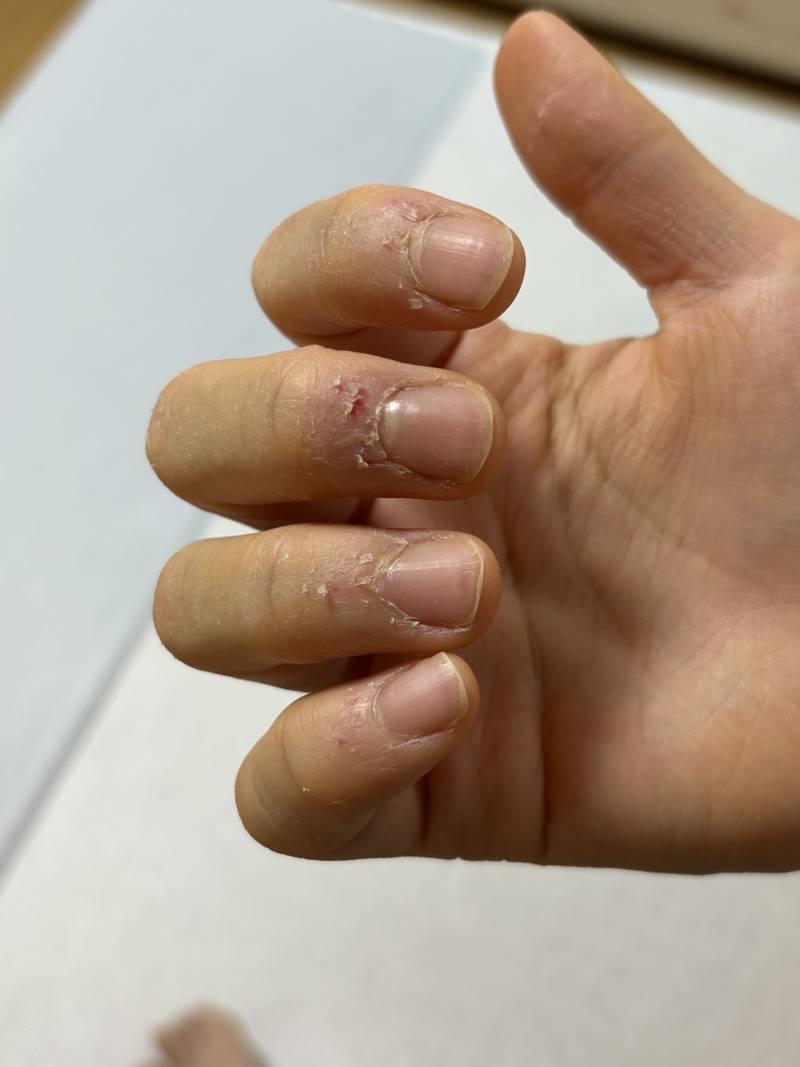 [잡담] 아니 이거 어캐 ? 왤케 심하지 | 인스티즈