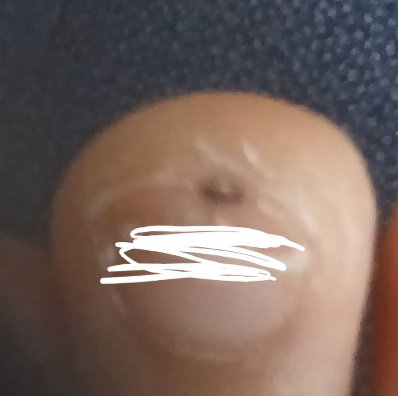 [잡담] 혹시 발톱에 이런 점 생겨본 익 있어? 이거 병원 가봐야하나 | 인스티즈