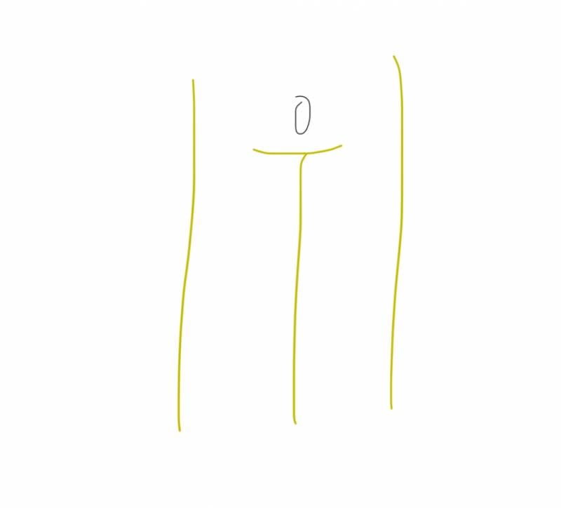 [잡담] 브라질리언 레이저 한 사람 있어? Tmi같은 질문이긴한데 | 인스티즈