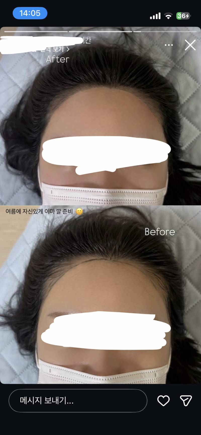 [잡담] 문신샵에서 허락없이 내얼굴 다 올렸어 40 | 인스티즈