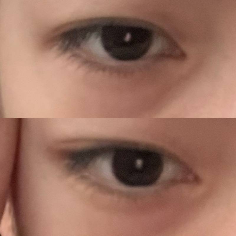 [잡담] 내눈 장단점 다있는데 단점이 너무큼 | 인스티즈