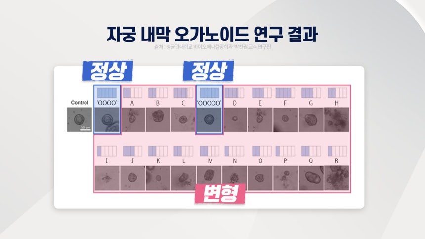 [정보/소식] [단독] 국내 연구진, 유기농 생리대 실험…"14개 중 12개 '자궁 내막 세포 변형'” | 인스티즈