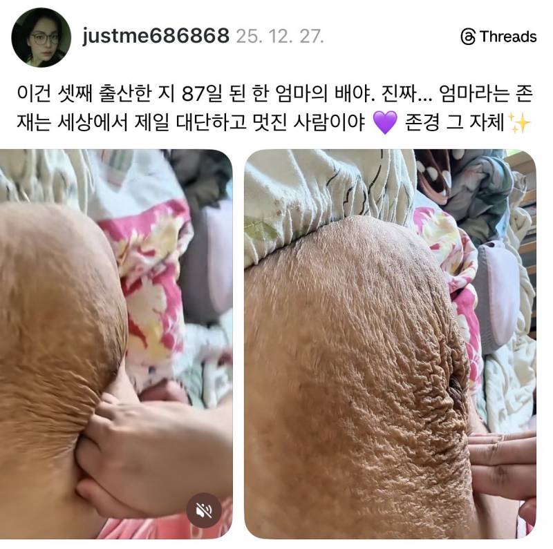현재 스레드에서 논란중인 셋째 낳은 배 사진..JPG | 인스티즈