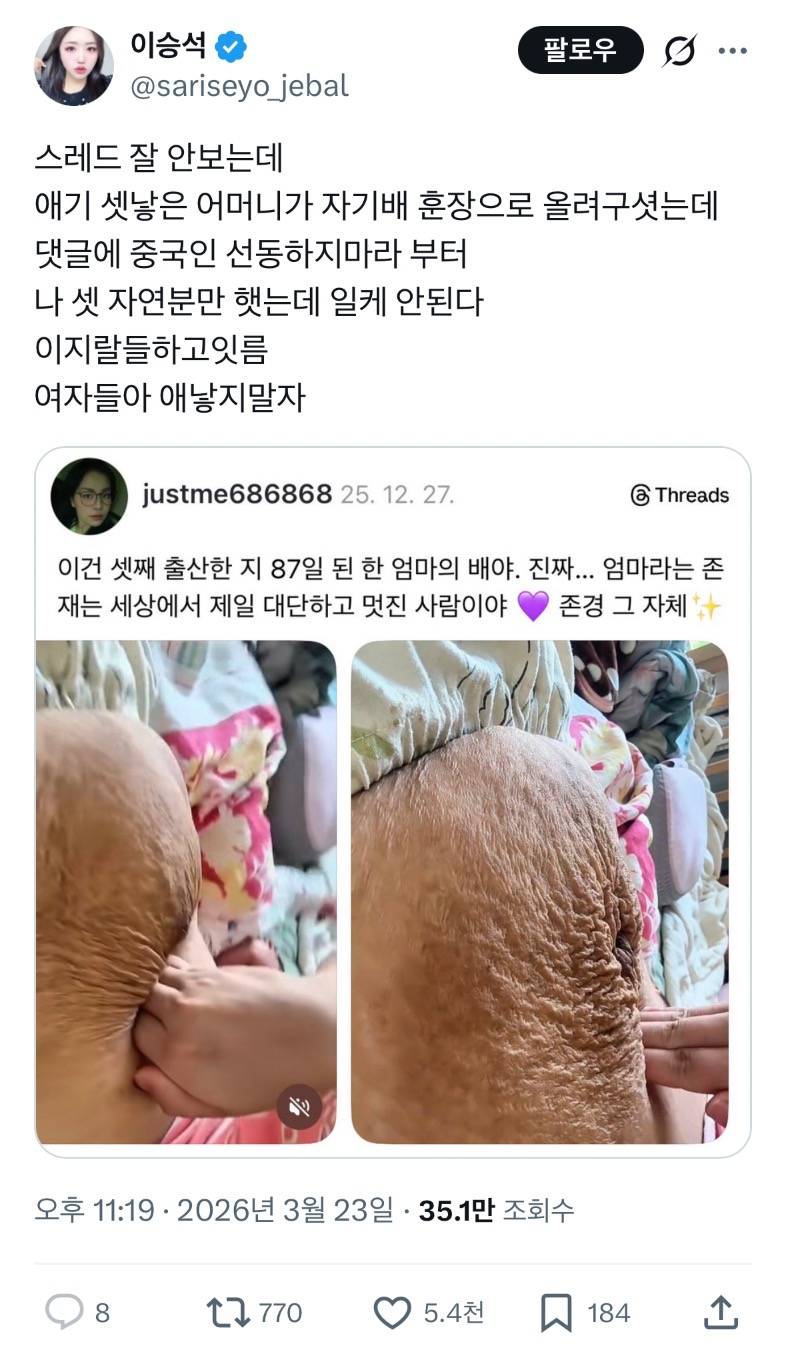 현재 스레드에서 논란중인 셋째 낳은 배 사진..JPG | 인스티즈