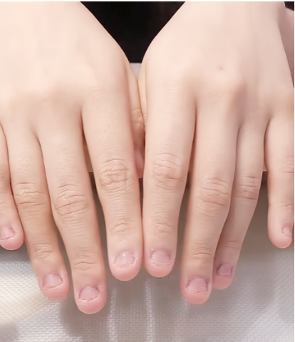 [잡담] 손톱 물어뜯는 버릇 보통 성인되면 고치지 않아? | 인스티즈
