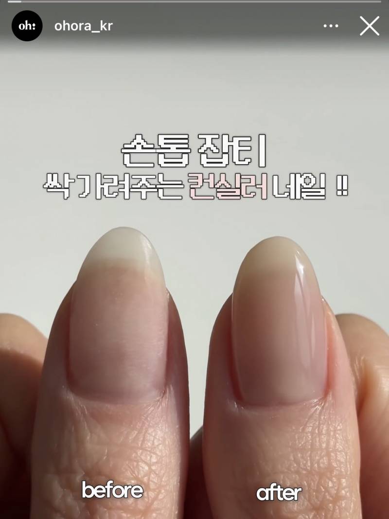 [잡담] 홀서빙하는데 손톱강화제도 안되겠지 | 인스티즈