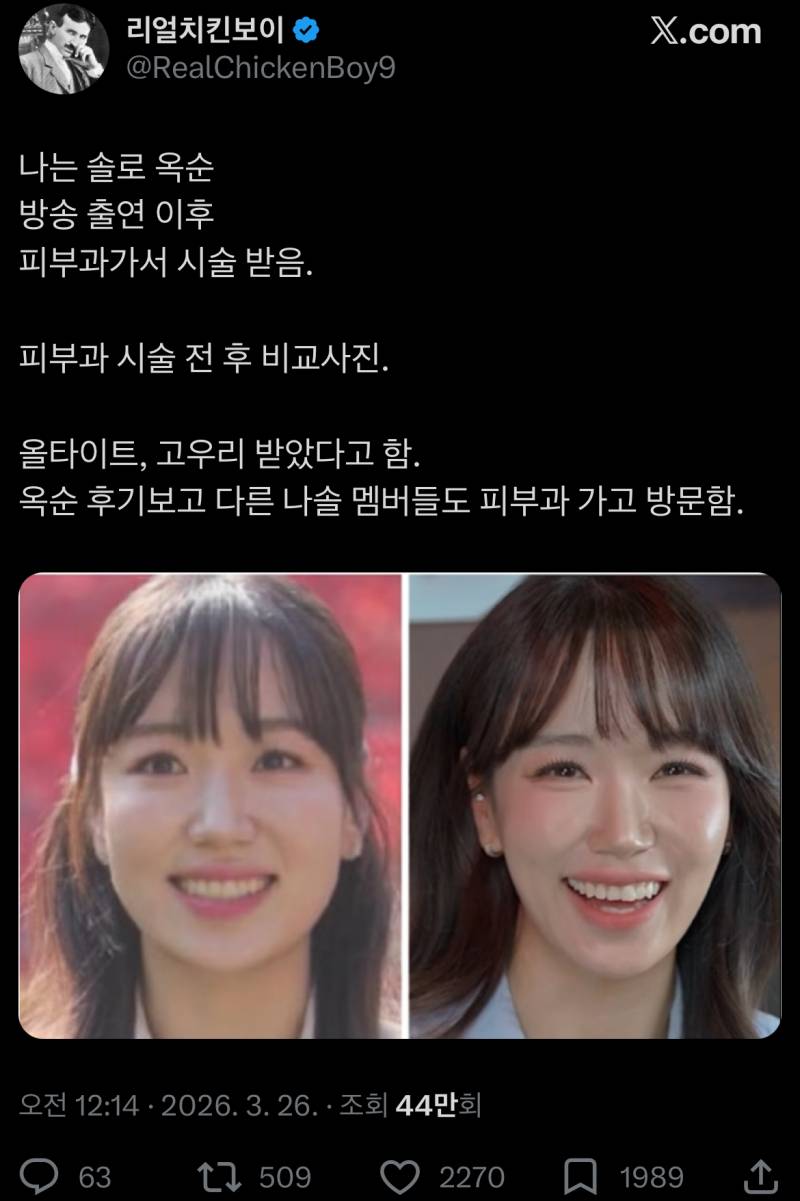 [잡담] 내가 미감이 별로인건가 옥순 시술 전이 더 예쁜데 | 인스티즈