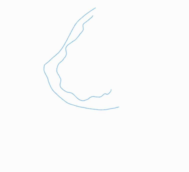 [잡담] 익들아 내 유방암 자가검진 좀 봐줘..(숭함주의) | 인스티즈