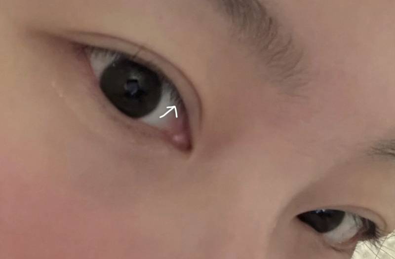 [잡담] 눈 윗트임 할말 | 인스티즈