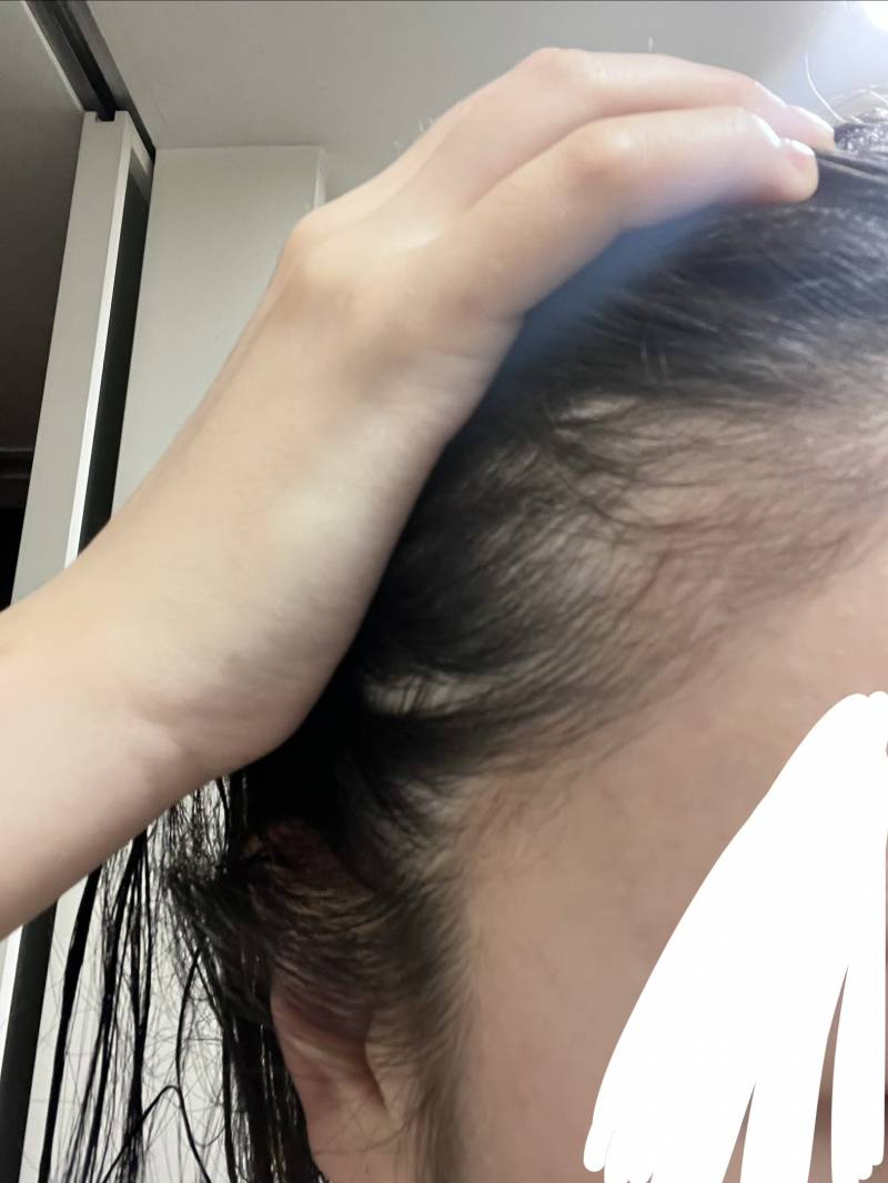 [잡담] 문신샵에서 내 얼굴 허락없이 올렸다는 글 후기야 | 인스티즈