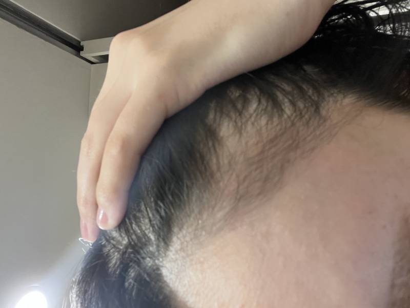 [잡담] 문신샵에서 내 얼굴 허락없이 올렸다는 글 후기야 | 인스티즈