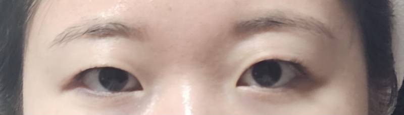 [잡담] 나 짝눈 너무 심해... | 인스티즈