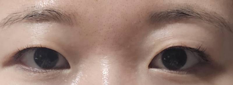 [잡담] 나 짝눈 너무 심해... | 인스티즈
