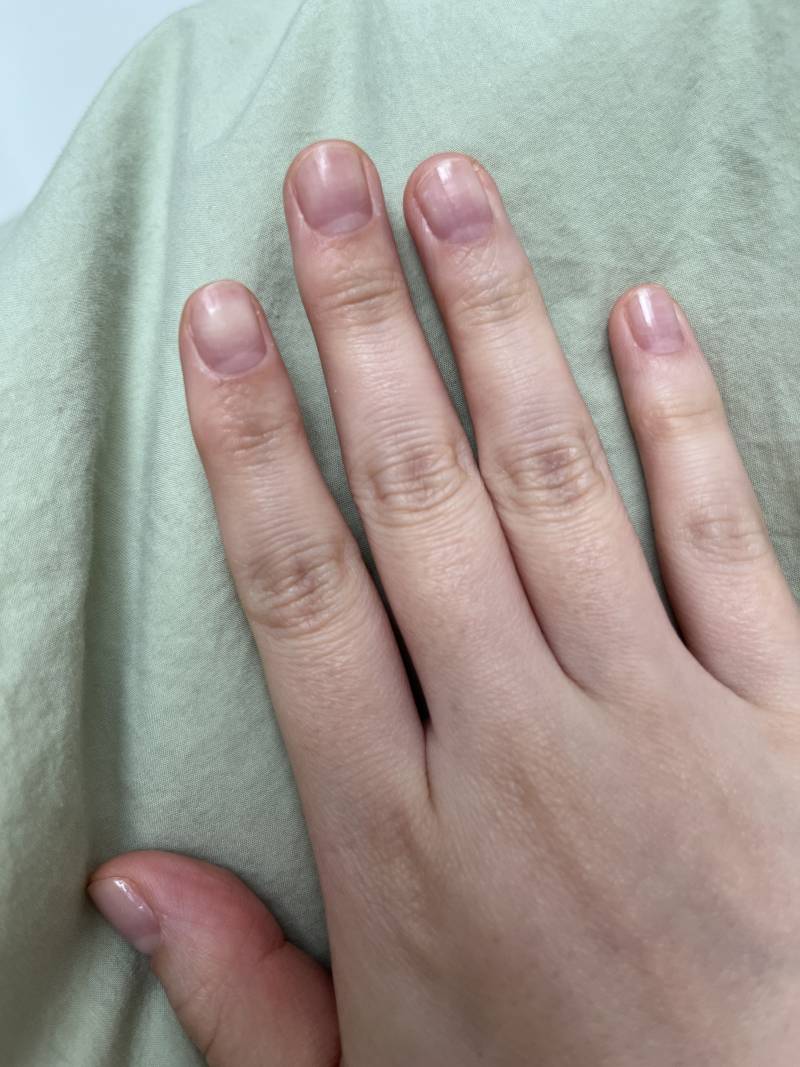 [잡담] 내 손톱 너무 짧아? | 인스티즈
