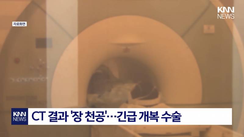 (충격주의) 항문에 깐 달걀 15개 넣은 남..JPG | 인스티즈