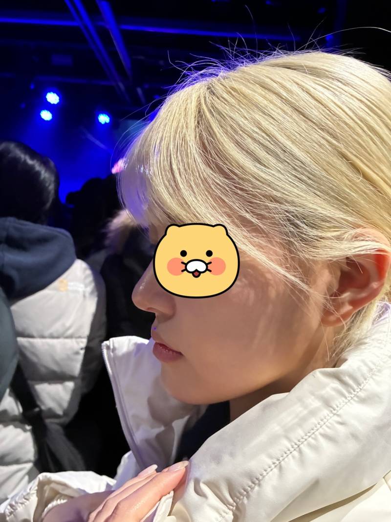 [잡담] 주걱턱 양악할 수준임? | 인스티즈