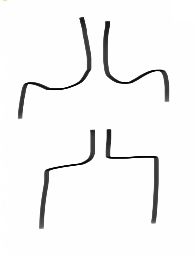 [잡담] 이런게 라운드 숄더야?? | 인스티즈