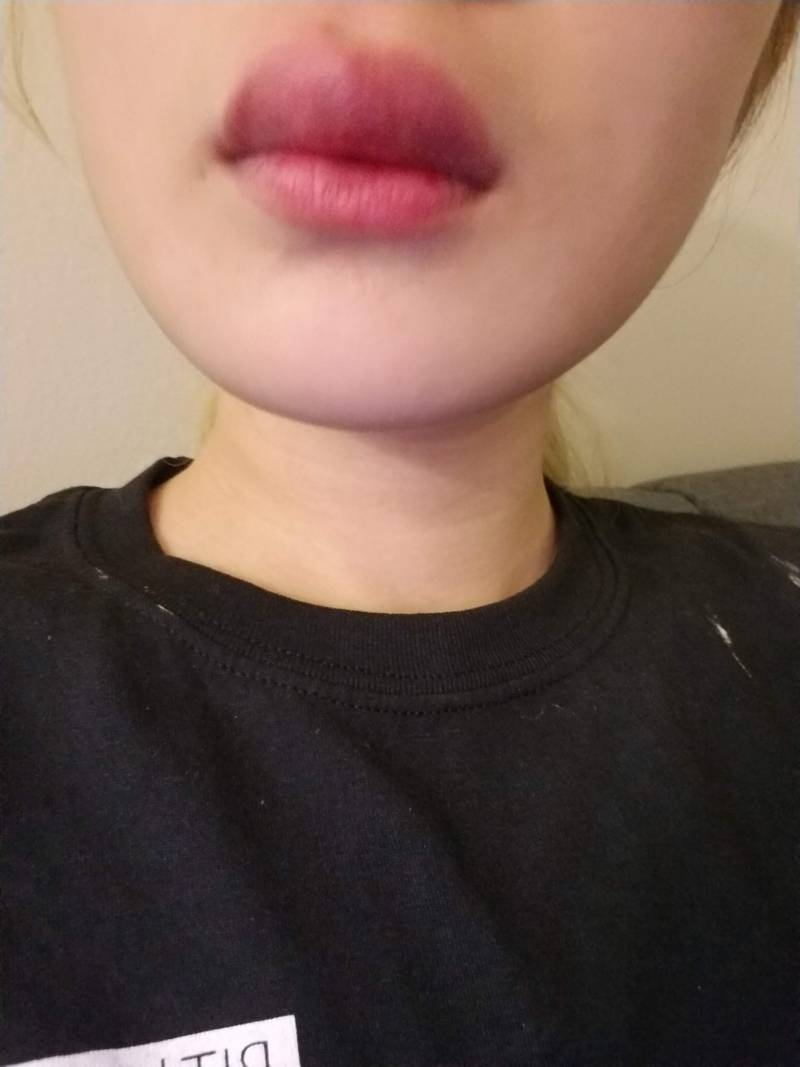 [잡담] 알러지 조심해 ㅎㅇㅈㅇ | 인스티즈