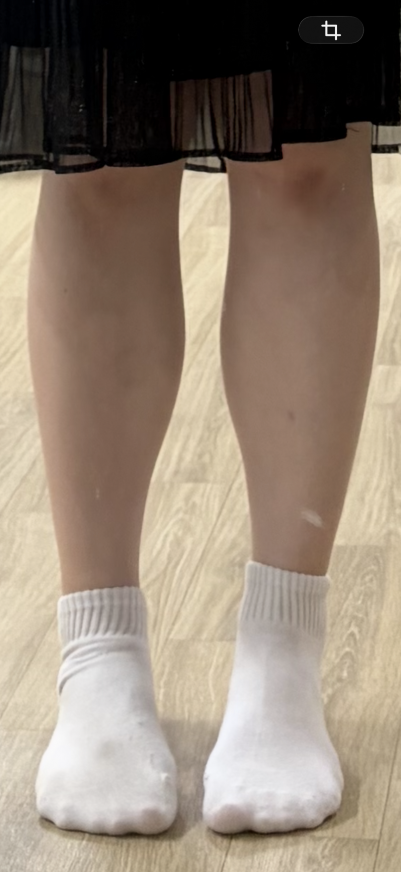 [잡담] 아니 나 종아리 ㅈ니짜 어떻게 해야돼? | 인스티즈