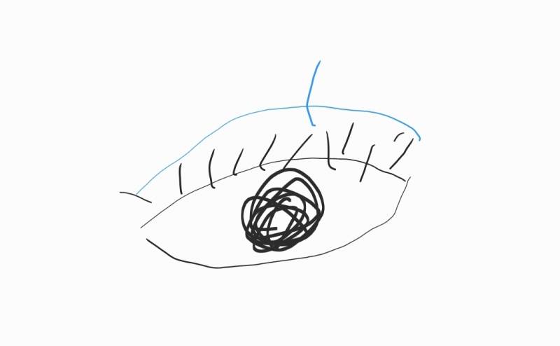 [잡담] 속눈썹이 눈두덩이에도 나는구나 | 인스티즈