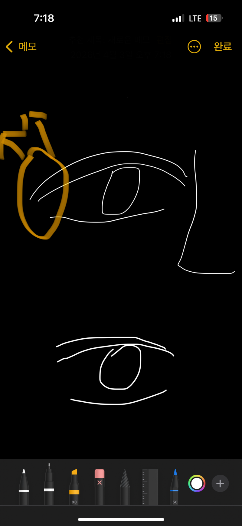 [잡담] 눈 윗쪽 올리는 수술 아는 사람..? | 인스티즈