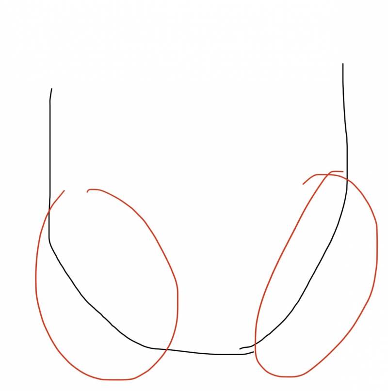 [잡담] 사각턱 보톡스 맞아본 익들아 들어와봐!!!!! | 인스티즈