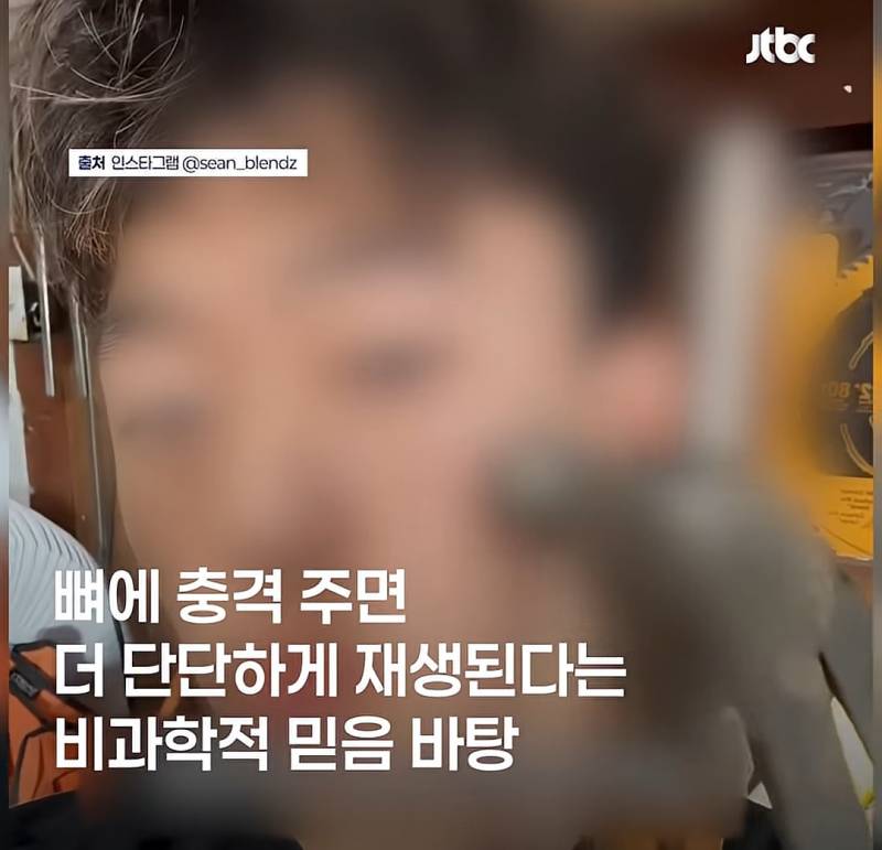 요즘 미국 젠지남에겐 중안부 수준인 턱라인 정병..JPG | 인스티즈