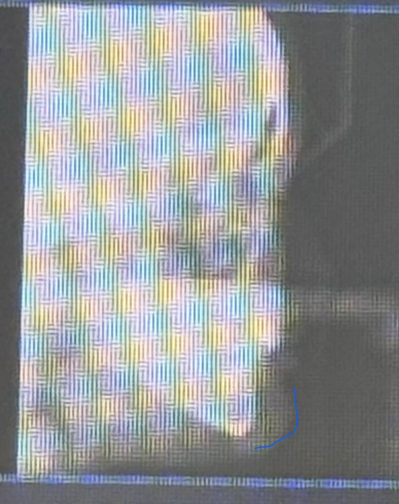 [잡담] 아래턱 나온거 들어가게 할 수 있는 방법 아는분 ㅠㅠ | 인스티즈